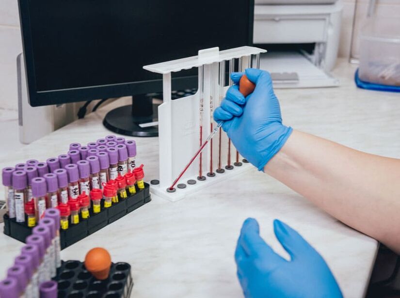 measure blood sugar level after drinking alcohol